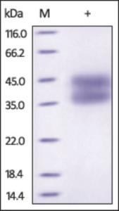 The purity of rh IL2RA /CD25 was determined by DTT-reduced (+) SDS-PAGE and staining overnight with Coomassie Blue.