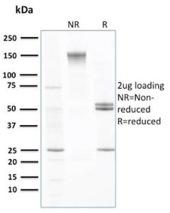 SDS-PAGE analysis of Anti-Transthyretin Antibody [CPTC-TTR-1] under non-reduced and reduced conditions; showing intact IgG and intact heavy and light chains, respectively. SDS-PAGE analysis confirms the integrity and purity of the antibody