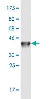 Anti-DAB2IP Mouse Monoclonal Antibody [clone: 8C10]