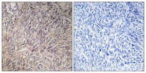 Anti-FGF22 Rabbit Polyclonal Antibody