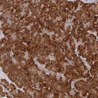 Anti-ARHGEF10L Rabbit Polyclonal Antibody