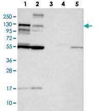 Anti-CBLB Rabbit Polyclonal Antibody