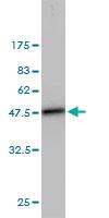 Anti-UBE2L3 Mouse Monoclonal Antibody [clone: 3B7]