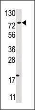 Anti-USP16 Rabbit Polyclonal Antibody (HRP (Horseradish Peroxidase))