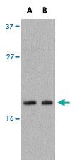 Anti-OCIAD2 Rabbit Polyclonal Antibody