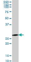 Anti-ACSF2 Mouse Polyclonal Antibody