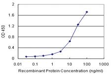 Anti-MBD5 Antibody Pair