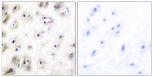 Immunohistochemical analysis of paraffin-embedded human brain tissue using Anti-Amylin Antibody. The right hand panel represents a negative control, where the Antibody was pre-incubated with the immunising peptide