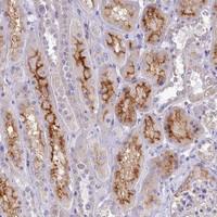 Anti-VPS26B Rabbit Polyclonal Antibody