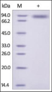 The purity of rh IL2RG Fc Chimera was determined by DTT-reduced (+) SDS-PAGE and staining overnight with Coomassie Blue.