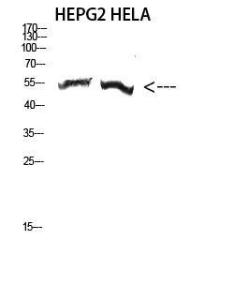 Anti-TUBA3C and TUBA3E antibody