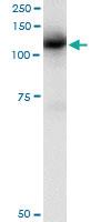 Anti-CBL Mouse Monoclonal Antibody