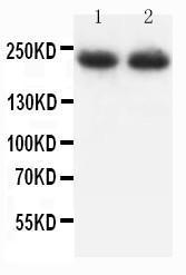 Anti-Myosin (Skeletal, Fast) Mouse Monoclonal Antibody [clone: MY-38]