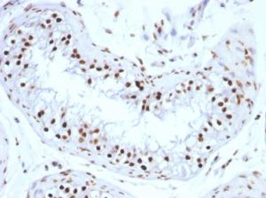 Immunohistochemical analysis of formalin-fixed, paraffin-embedded human testicular carcinoma using Anti-Histone H1 Antibody [SPM256]