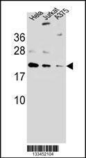 Anti-ARL6IP6 Rabbit Polyclonal Antibody (HRP (Horseradish Peroxidase))