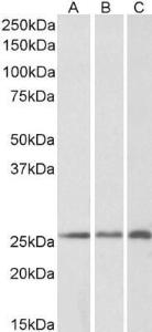 Anti-CSRP2 Antibody (A84429) (02 µg/ml) staining of Human (A), Mouse (B) and Rat (C) Kidney lysates (35 µg protein in RIPA buffer) Primary incubation was 1 hour Detected by chemiluminescence