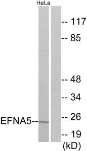 Western blot analysis of lysates from HeLa cells using Anti-EFNA5 Antibody The right hand lane represents a negative control, where the antibody is blocked by the immunising peptide