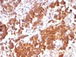 Anti-TNFS15 Mouse Recombinant Antibody [clone: rVEGI/1283]