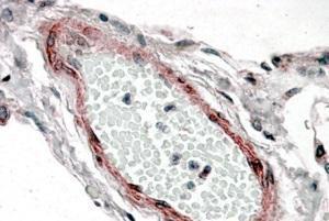 Anti-CSRP2 Antibody (A84429) (38 µg/ml) staining of paraffin embedded Human Lung Steamed antigen retrieval with citrate buffer pH 6, AP-staining