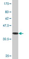 Anti-TUBA1A Mouse Monoclonal Antibody [clone: 2D2]