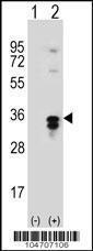 Anti-PPT1 Rabbit Polyclonal Antibody (PE (Phycoerythrin))