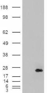 HEK293 overexpressing CRP2 (RC201565) and probed with Anti-CSRP2 Antibody (A84429) (mock transfection in first lane), tested by Origene