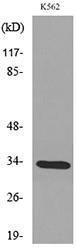 Western blot analysis of lysate from K562 cells using Anti-SFTPA1 + SFTPA2 Antibody