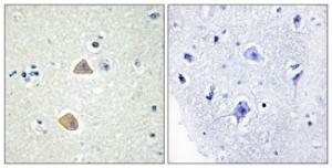 Immunohistochemical analysis of paraffin-embedded human brain tissue using Anti-EFNA5 Antibody The right hand panel represents a negative control, where the antibody was pre-incubated with the immunising peptide