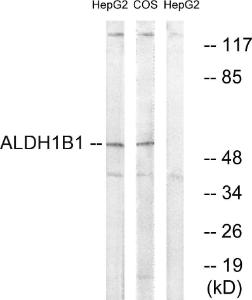 Anti-ALDH1B1 antibody