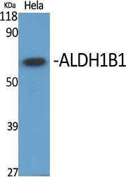 Anti-ALDH1B1 antibody