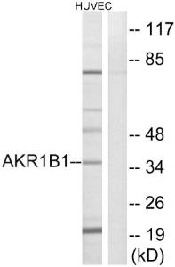 Western blot analysis of lysates from HUVEC cells using Anti-AKR1B1 Antibody. The right hand lane represents a negative control, where the antibody is blocked by the immunising peptide