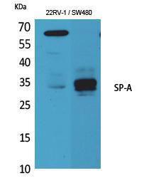 Western blot analysis of K56 mouse lung cells using Anti-SFTPA1 + SFTPA2 Antibody