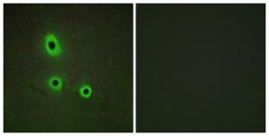 Immunofluorescence analysis of A549 cells using Anti-EFNA5 Antibody The right hand panel represents a negative control, where the antibody was pre-incubated with the immunising peptide