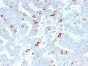 Immunohistochemical analysis of formalin-fixed, paraffin-embedded human colon using Anti-MUC2 Antibody [mlP/2970R]