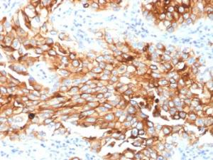 Anti-Mesothelin Mouse Monoclonal Antibody [clone: MSLN/2131]