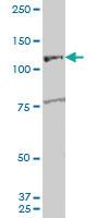 Anti-ARHGEF1 Mouse Polyclonal Antibody