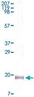 Anti-IL16 Mouse Monoclonal Antibody [clone: 1F12D7]