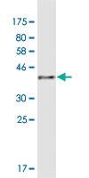 Anti-AKR1C8P Mouse Monoclonal Antibody [clone: 4G8]