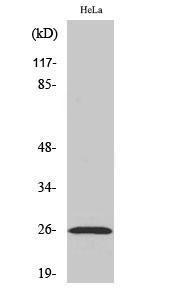 Western blot analysis of various cells using Anti-EFNA5 Antibody