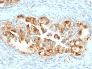 Anti-Mesothelin Mouse Monoclonal Antibody [clone: MSLN/2131]