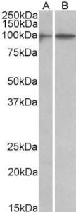 Anti-HIC1 antibody