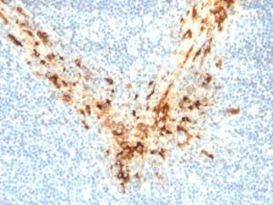 Anti-Mesothelin Mouse Monoclonal Antibody [clone: MSLN/2131]