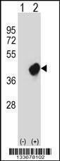 Anti-CRKL Rabbit Polyclonal Antibody (Biotin)