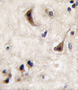 Anti-PTPN5 Rabbit Polyclonal Antibody