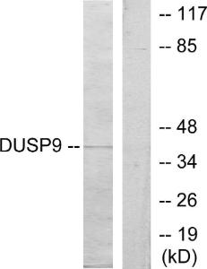 Anti-DUSP9 Rabbit Polyclonal Antibody