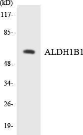 Western blot analysis of the lysates from HepG2 cells using Anti-ALDH1B1 Antibody