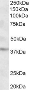 EB09816 (2 µg/ml) staining of Human Cerebral Cortex lysate (35 µg protein in RIPA buffer). Primary incubation was 1 hour. Detected by chemiluminescence.