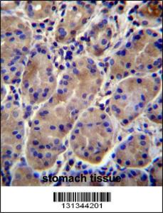 Anti-KCNJ13 Rabbit Polyclonal Antibody (AP (Alkaline Phosphatase))