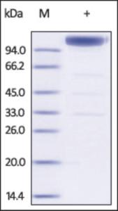 The purity of Mouse IL6ST /GP130 /CD130 Fc Chimera was determined by DTT-reduced (+) SDS-PAGE and staining overnight with Coomassie Blue.