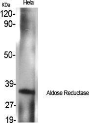 Western blot analysis of various cells using Anti-AKR1B1 Antibody